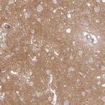 PCDH1 Antibody in Immunohistochemistry (Paraffin) (IHC (P))