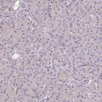 PCDH1 Polyclonal Antibody