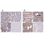 TMP21 Polyclonal Antibody