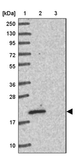 TMP21 Antibody in Western Blot (WB)
