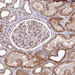 LAP1 Antibody in Immunohistochemistry (Paraffin) (IHC (P))