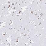 FAM3C Antibody in Immunohistochemistry (Paraffin) (IHC (P))