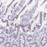 FAM3C Antibody in Immunohistochemistry (Paraffin) (IHC (P))
