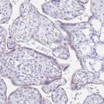 FAM3C Antibody in Immunohistochemistry (Paraffin) (IHC (P))
