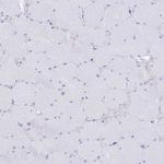 FAM3C Antibody in Immunohistochemistry (Paraffin) (IHC (P))