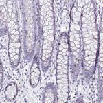 Anillin Antibody in Immunohistochemistry (Paraffin) (IHC (P))