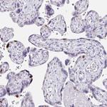 Anillin Antibody in Immunohistochemistry (Paraffin) (IHC (P))