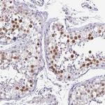 Anillin Antibody in Immunohistochemistry (Paraffin) (IHC (P))
