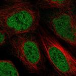 ZBTB10 Polyclonal Antibody