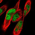 C10orf46 Polyclonal Antibody