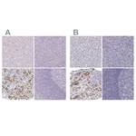 PIT1 Antibody in Immunohistochemistry (Paraffin) (IHC (P))