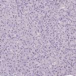 PIT1 Antibody in Immunohistochemistry (Paraffin) (IHC (P))