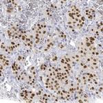 PIT1 Antibody in Immunohistochemistry (Paraffin) (IHC (P))