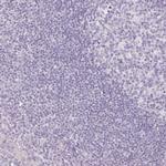 PIT1 Antibody in Immunohistochemistry (Paraffin) (IHC (P))