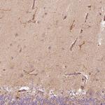 Fascin Polyclonal Antibody