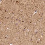 Fascin Antibody in Immunohistochemistry (Paraffin) (IHC (P))