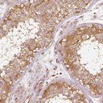 Fascin Antibody in Immunohistochemistry (Paraffin) (IHC (P))