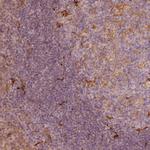 Fascin Antibody in Immunohistochemistry (Paraffin) (IHC (P))