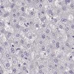 PBK Antibody in Immunohistochemistry (Paraffin) (IHC (P))