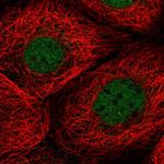 TMEM94 Antibody in Immunocytochemistry (ICC/IF)
