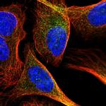 NAA15 Polyclonal Antibody