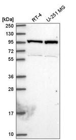 NAA15 Antibody in Western Blot (WB)