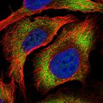 ZC3HAV1L Polyclonal Antibody