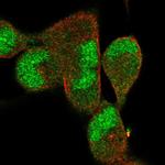 DNAJB5 Polyclonal Antibody