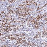 KCTD15 Antibody in Immunohistochemistry (Paraffin) (IHC (P))