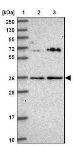 KCTD15 Antibody in Western Blot (WB)