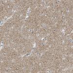 SLC25A23 Polyclonal Antibody