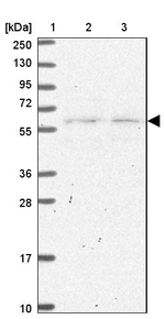 SLC25A23 Antibody in Western Blot (WB)