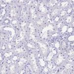 OATP8 Antibody in Immunohistochemistry (Paraffin) (IHC (P))