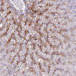 OATP8 Antibody in Immunohistochemistry (Paraffin) (IHC (P))