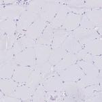 OATP8 Antibody in Immunohistochemistry (Paraffin) (IHC (P))