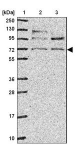 CD229 Antibody in Western Blot (WB)