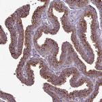 Clathrin Light Chain A Antibody in Immunohistochemistry (Paraffin) (IHC (P))