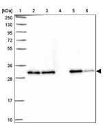 Clathrin Light Chain A Antibody in Western Blot (WB)