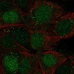 TPI1 Polyclonal Antibody