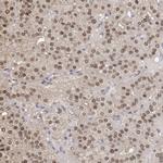 TPI1 Antibody in Immunohistochemistry (Paraffin) (IHC (P))