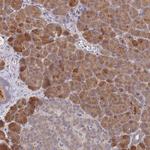 PPP6C Antibody in Immunohistochemistry (Paraffin) (IHC (P))