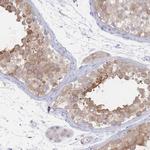 PPP6C Polyclonal Antibody