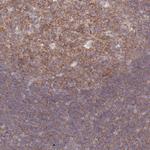 PPP6C Antibody in Immunohistochemistry (Paraffin) (IHC (P))