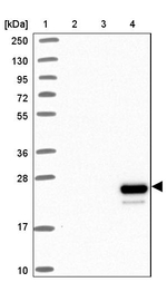 Apolipoprotein M Antibody in Western Blot (WB)
