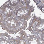 ADCK1 Antibody in Immunohistochemistry (Paraffin) (IHC (P))