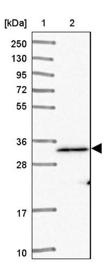 ADCK1 Antibody in Western Blot (WB)