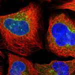 ARFGAP1 Polyclonal Antibody