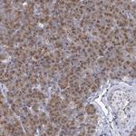 ARFGAP1 Antibody in Immunohistochemistry (Paraffin) (IHC (P))