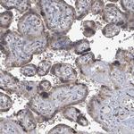 ARFGAP1 Antibody in Immunohistochemistry (Paraffin) (IHC (P))