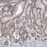 ARFGAP1 Antibody in Immunohistochemistry (Paraffin) (IHC (P))
